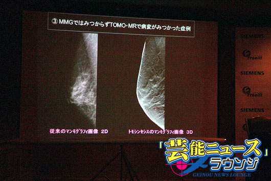 木佐彩子、乳がん検診は胃カメラより楽！最先端の3D検査装置に「3度目はこれ！」