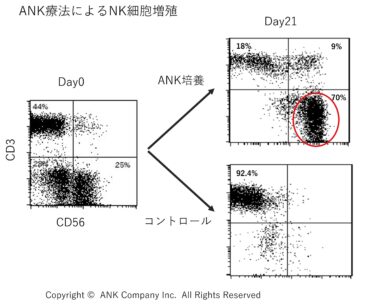 ANK療法はATLの第一治療として大きな可能性を示す　リンパ球バンクがANK免疫細胞療法のための培養センターを提供